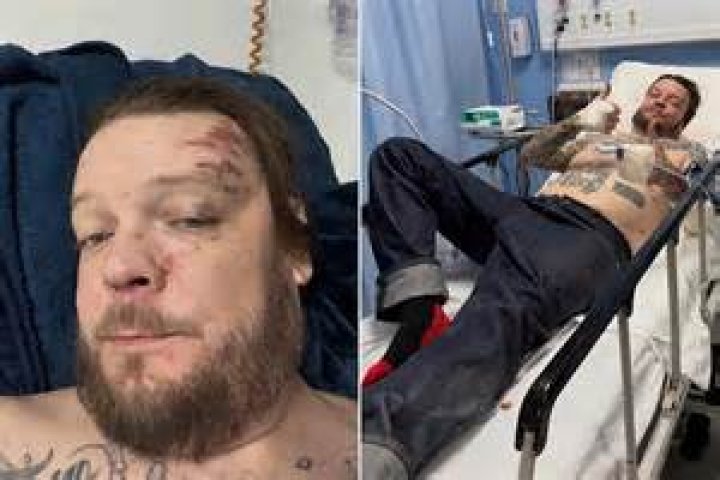 Did Corey Harrison From Pawn Stars Suffer A Stroke? Exclusive Details