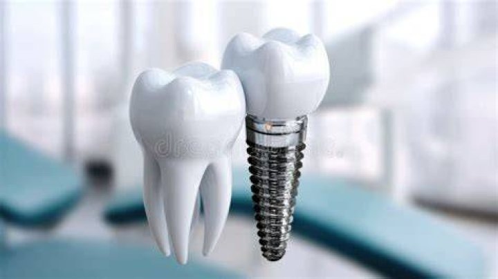 Tooth anchor